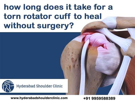 what test for rotator cuff tear|how do i know if need rotator cuff surgery.